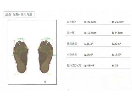 痛みが始まったのは社会人になってから