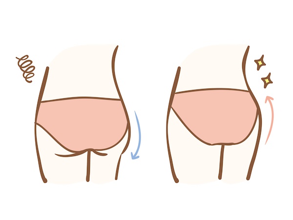 食い込まないショーツの特徴とは?