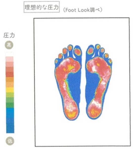 ひざが影響? 「土踏まず」が消えた衝撃