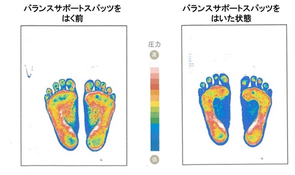 もしかして下半身の筋肉の「バランス崩れ」のせい?