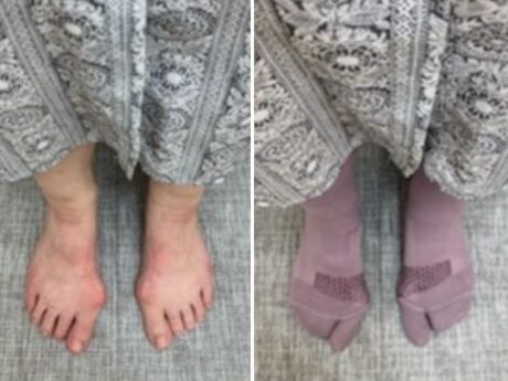 いざ検証！外反母趾サポートソックスをはいたら「夕方も足がラク！」