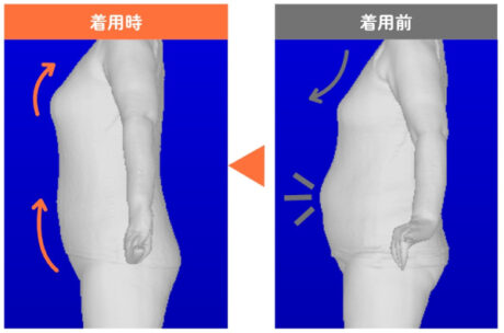 ぽっこりが変わった！　衝撃の3Dビフォーアフター