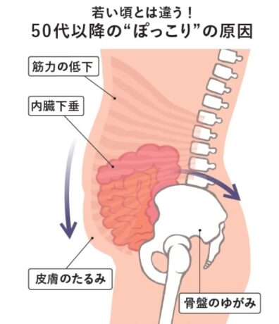 どうしてなかなかへこまない？50代からのぽっこりの原因