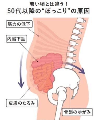 やせなくてもスッキリ！「骨盤が立つ」とぽっこりおなかが引っ込む仕組み